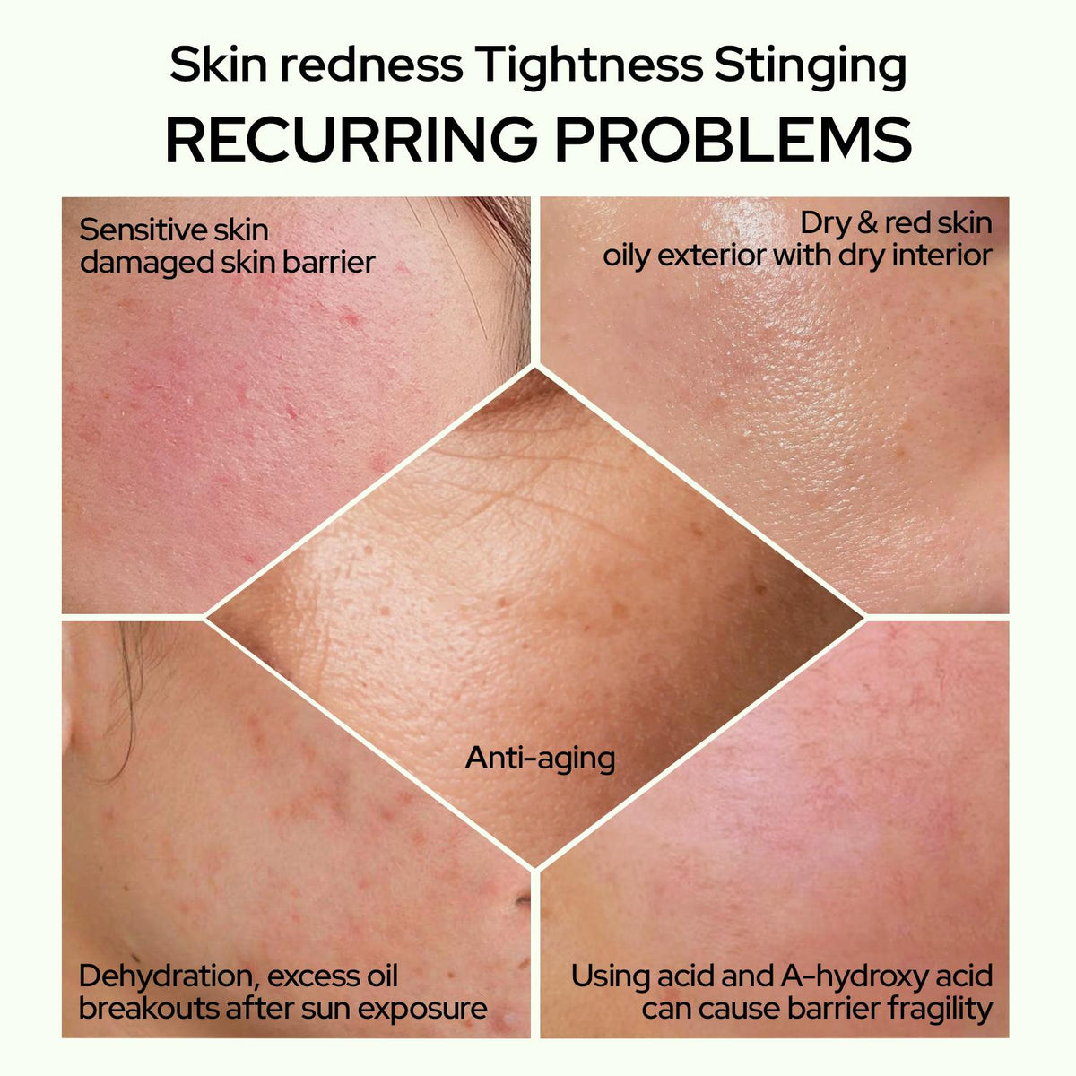 Chasteland Repairing Cream: Soothing, hydrating, and gentle—the top choice for sensitive skin. Wrinkle care that alleviates sensitivity while infusing sagging skin with plump elasticity; a premium at-home spa ritual.Korean skincare